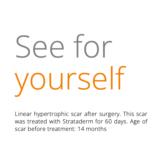 Strataderm Scar Therapy Cream 50g
